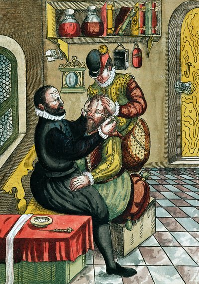 Szürkehályog műtét, az Ophthalmodouleia-ból Georg Bartisch (1535-1636) Drezdában 1583-ban (színes fatömbnyomat) alkotó: German School