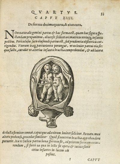 Nem egypetéjű ikrek az anyaméhben, illusztráció a 14. fejezetből, Rueff Az ember fogantatásáról és növekedéséről, 1587. alkotó: German School