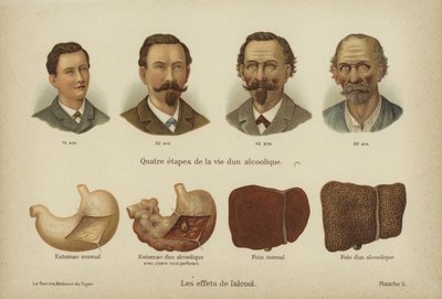 Az alkoholfogyasztás hatásai (színes litho) alkotó: German School