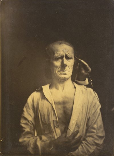 Görcs a m. corrugator supercilii nagyon erős fényben (balra); Nyugodt arc (teljes napsütésben fényképezve) (jobbra) alkotó: Guillaume Benjamin Amant Duchenne