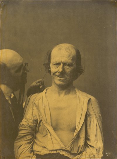 Nyugodt arc (balra); Hamis öröm vagy nevetés (jobbra),1854-1856, nyomtatva 1862 (fotó) alkotó: Guillaume-Benjamin-Armand Duchenne de Boulogne