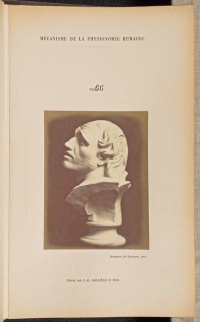 Ábra. 66 alkotó: Guillaume-Benjamin Duchenne
