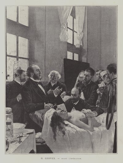 Avant lOperation (a művelet előtt) alkotó: Henri Gervex