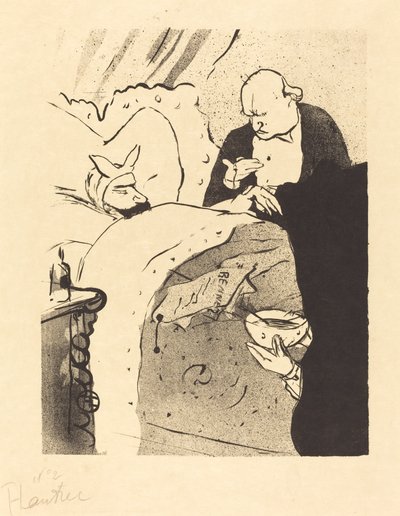 Beteg Carnot! (Carnot malade!) alkotó: Henri de Toulouse Lautrec