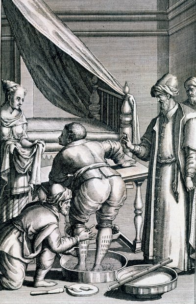 Vérömlés a lábakban, Prospero Alpini Medicina Aegyptiorumból, 1745-ben alkotó: Italian School
