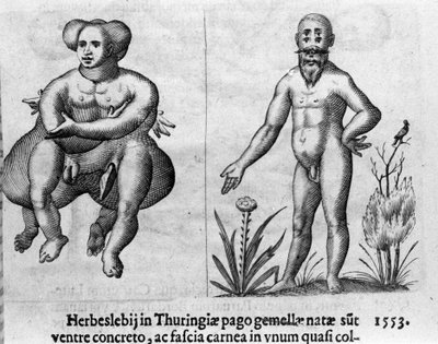 Különböző típusú emberi szörnyek. Metszet Fortunio Norsi (1577-1656) olasz tudós "A szörnyek természete, okaik és különbségeik" című könyvéből. 1646 alkotó: Italian School