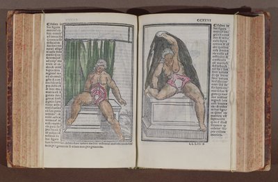 Női anatómia, a világ anatómiájáról szóló kommentárokból a legnagyszerűbb kiegészítésekkel, Jacopo Berengario da Carpi (kb. 1460-kb. 1530) Bolognában, 1521-ben (színes fatömbnyomat) alkotó: Italian School