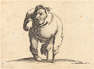 Mankóval és fa lábbal rokkant alkotó: Jacques Callot
