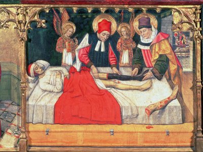 126-0035321 SS. Cosmas és Damian egy etióp férfi lábát oltják Justinianus diakónus csonkjára; alkotó: Jaume Huguet