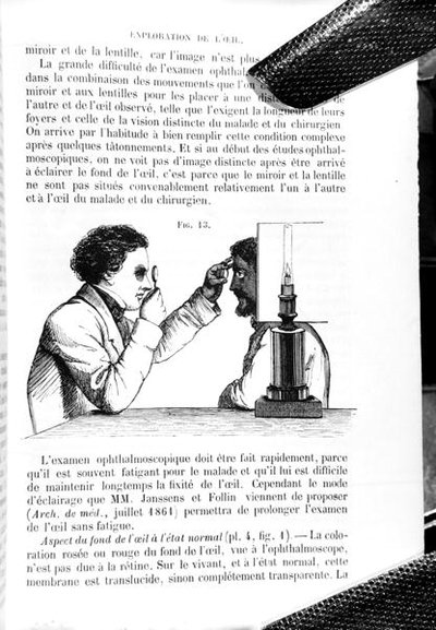Illusztráció a „Traite Pratique des Maladies des Yeux”, „A Manual on the Principles and Practice of Ophthalmic Medicine and Surgery” fordítása, Thomas Wharton Jones (1808-91), E. Foucher, kiadva Párizsban 1862 (metszet) (sz. /w fotó) alkotó: Jean Francois Badoureau
