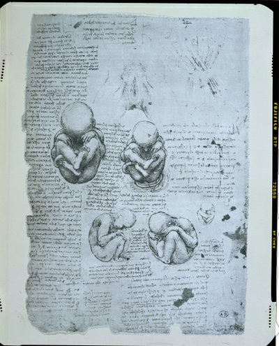 Öt nézet egy magzatról az anyaméhben, fakszimile másolat alkotó: Leonardo da Vinci