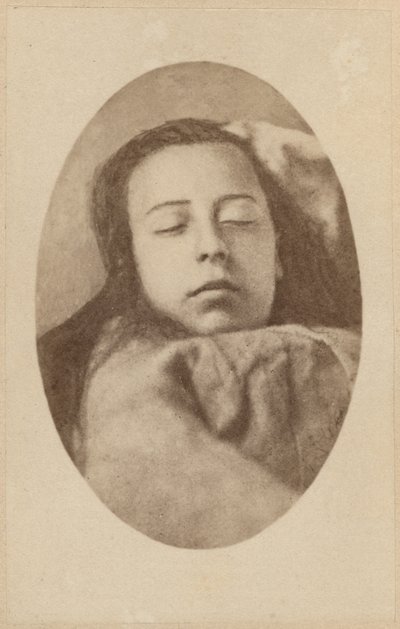A hisztéria támadása, második fázis, illusztráció a Bourneville et P. Regnard „Iconographie Photographique de La Salpetriere” című művéből, III. tábla, Párizs, 1876 (albumnyomat) alkotó: Paul Regnard