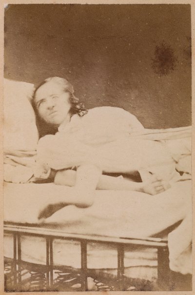 Hisztérikus epilepszia, torzulások, XXXVIII. lemez a Bourneville et P. által készített "Iconographie Photographique de La Salpetriere" című műből. Regnard, Párizs, 1876 (albumin nyomat) alkotó: Paul Regnard