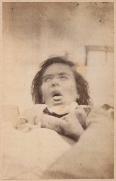Hisztérikus epilepszia, hallucinációk, szorongás, XXIX. tábla a Bourneville et P. "Iconographie Photographique de La Salpetriere" című művéből. Regnard, Párizs, 1876 (albumin nyomat) alkotó: Paul Regnard