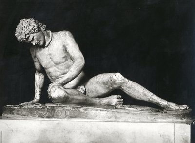 Haldokló Gallia, Epigonos (márvány) egy Kr.e. 230-220 körüli görög eredeti másolata (f/w fotó) alkotó: Roman Roman