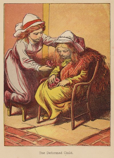 A torz gyermek (színes metszet) alkotó: Thomas Dalziel