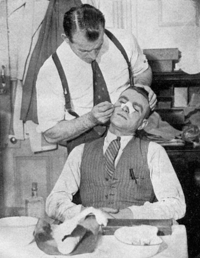 Eddie Hapgood angol csapatkapitányt egy 1934-es olaszországi meccs után orrtörése miatt kezelik. alkotó: Topical Press Agency