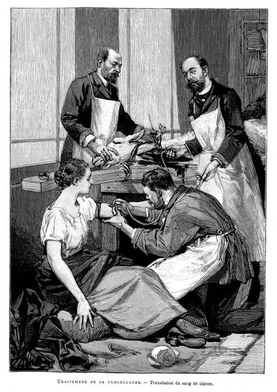 Egy tuberkulózisos betegnek kecskevért adnak át, 1891 alkotó: Unbekannt