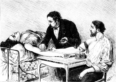 Dr. Roussell Genfből, aki egy nőnek közvetlen vérátömlesztést adott egy önkéntestől, 1882 alkotó: Unbekannt