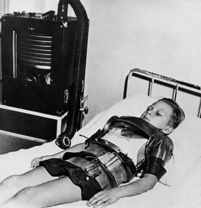 Tizenegy öreg fiú vastüdőben, Beaujon Kórház, Párizs, 1947-1951 alkotó: Unbekannt