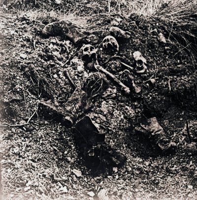 Emberi maradványok, c1914-c1918 alkotó: Unbekannt