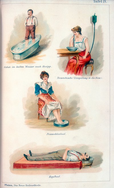 Hidroterápiás kezelések, c1902 alkotó: Unbekannt