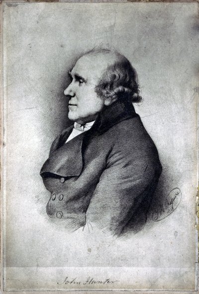 John Hunter brit sebész és anatómus, 1770 körül alkotó: Unbekannt