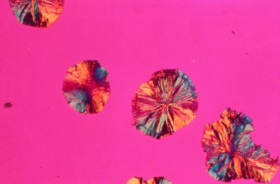 FÉMEK, VAS, LM Gömbgrafitos öntöttvas alkotó: Unbekannt