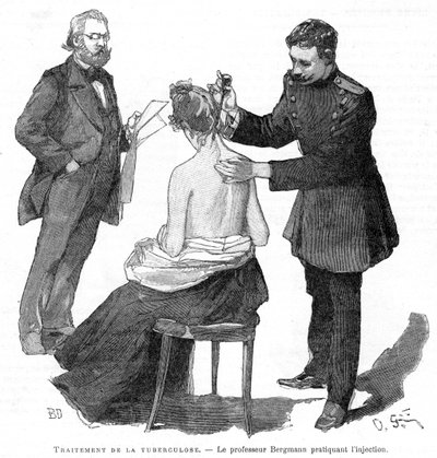 Bergmann professzor injekcióz egy tuberkulózisos beteget, 1891 alkotó: Unbekannt
