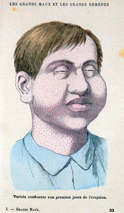 Himlő áldozata, 1890 alkotó: Unbekannt