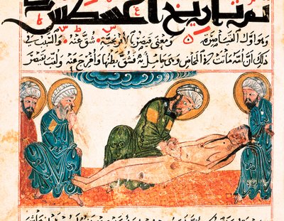 A császármetszés ábrázolása. Miniatűr Abu Raihan Al-Biruni (vagy Alberuni) (973-1048), perzsa értelmiségi és tudós orvosi kéziratából, 161. fólió. alkotó: Unbekannt