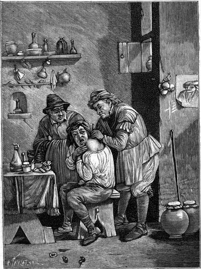 Egy sarlatán sebész a 18. században vállsérülést vizsgál. (Az idő metszetéből). Gravírozás: „” La Nature: revue des sciences et de leurs applications aux arts et a l