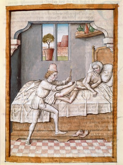 Egy orvos miniatűr beteget kezel Bidpai „Kalila (Calila) és Dimna” meséinek német fordításából. (ms. 1389, fol. 23) 1480 körül Chantilly, Museum Conde alkotó: Unknown artist
