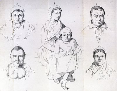 Morel megfontolások az endemikus kreténizmus okairól. alkotó: Unknown artist
