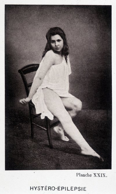 Hystero Epilepsia – kontraktúra a Salpétrière fényképészeti ikonográfiájában: Mr. Charcot szolgálata, Paul Regnard és Bourneville alkotó: Unknown artist