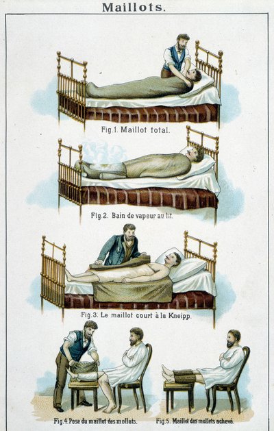 Mezek: 1) Teljes mez, 2) Gőzfürdő az ágyban, 3) Kneipp rövid trikó, 4-5) Borjú mez - a „Bilz, Natural Medicina”-ban, 19. század vége alkotó: Unknown artist