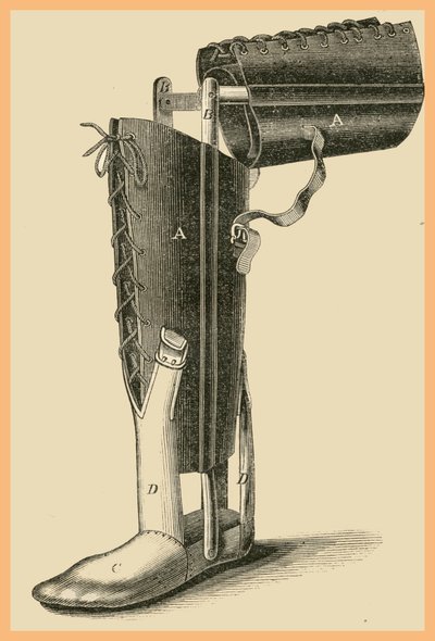 Láb cseréje alkotó: Unknown Artist