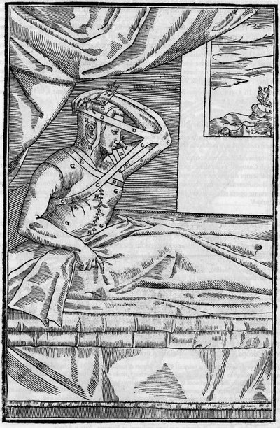 Orrműtét: Helyreállító műtét az orron a „De curtorum chirurgia per insitionem”-ben. Velence alkotó: Unknown artist