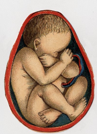 A méh ábrázolása terhességgel. „Az új természetes gyógyszer” – F.E. Bilz.1898. alkotó: Unknown artist