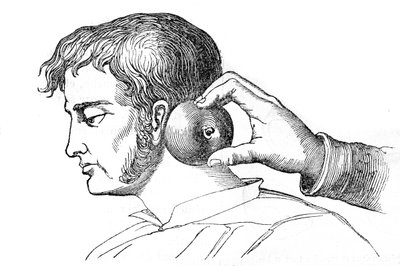 Saignee locales – piócák alkalmazása almával – gravírozás a „La Santo Universelle – Medical Guide for Families”-ben, 1852 alkotó: Unknown artist