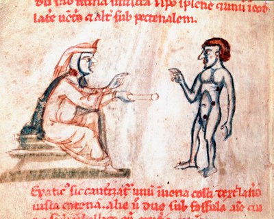 Az orvos megégeti a pácienst a fájdalmas területeken forró vasalóval Miniatűr a „” De Medicina cauteriorum secundum Brunum, Rugerium et Rolthe” kéziratból, 13. század Párizs, B.N. alkotó: Unknown artist