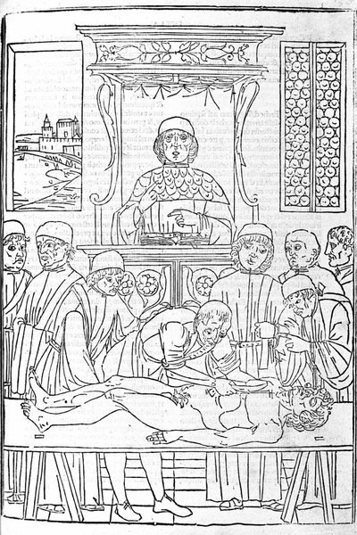 Anatómiai boncolás. Metszet Gerolamo Cardano (Cardanus Hieronymus) orvostudományi értekezéséből, Firenze alkotó: Unknown artist