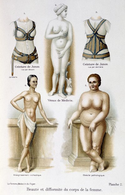 A női test szépsége és deformitása (soványság és elhízás); Juno övei – A nő, házi orvos alkotó: Unknown artist