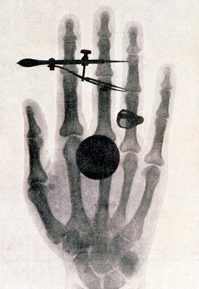 Wilhelm Roentgen röntgenfelvétele felesége kezéről, 1896 alkotó: Wilhelm Conrad Rontgen