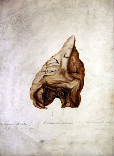 Study of Brain I, 1850 körül (akvarell papíron) alkotó: William Lover