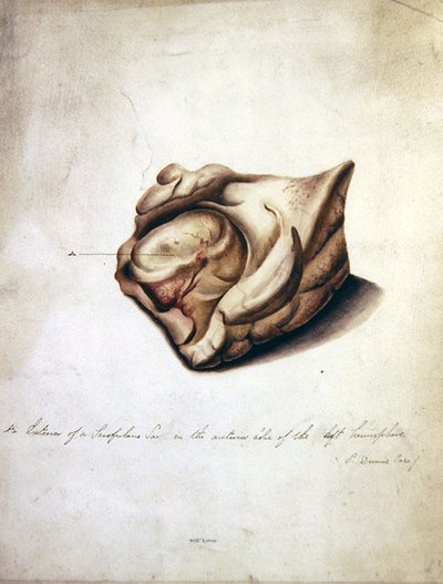 Study of the Brain II, 1850 körül (akvarell papíron) alkotó: William Lover