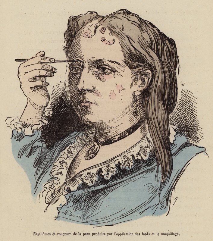 Nő a smink használatából eredő bőrkiütésekkel és bőrpírral (színes metszet) alkotó: (after) French School