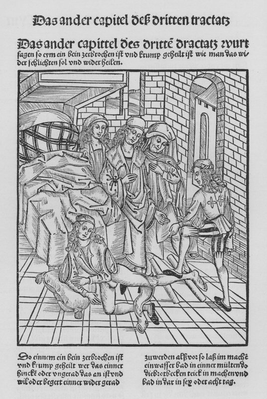 Hieronymus Brunschwig Cirurgia könyve (litho) alkotó: (after) German School