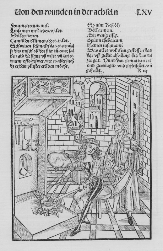 Hieronymus Brunschwig Cirurgia könyve (litho) alkotó: (after) German School