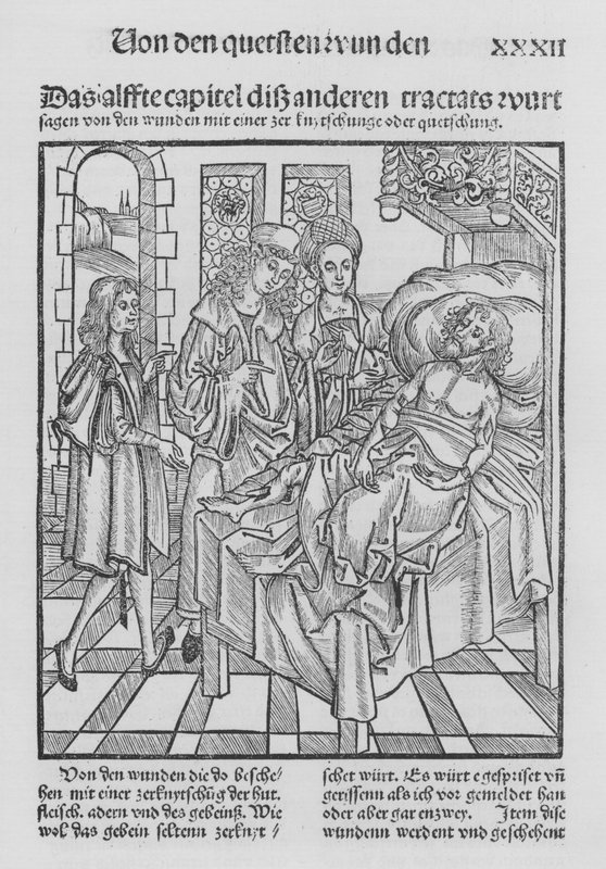 Hieronymus Brunschwig Cirurgia könyve (litho) alkotó: (after) German School